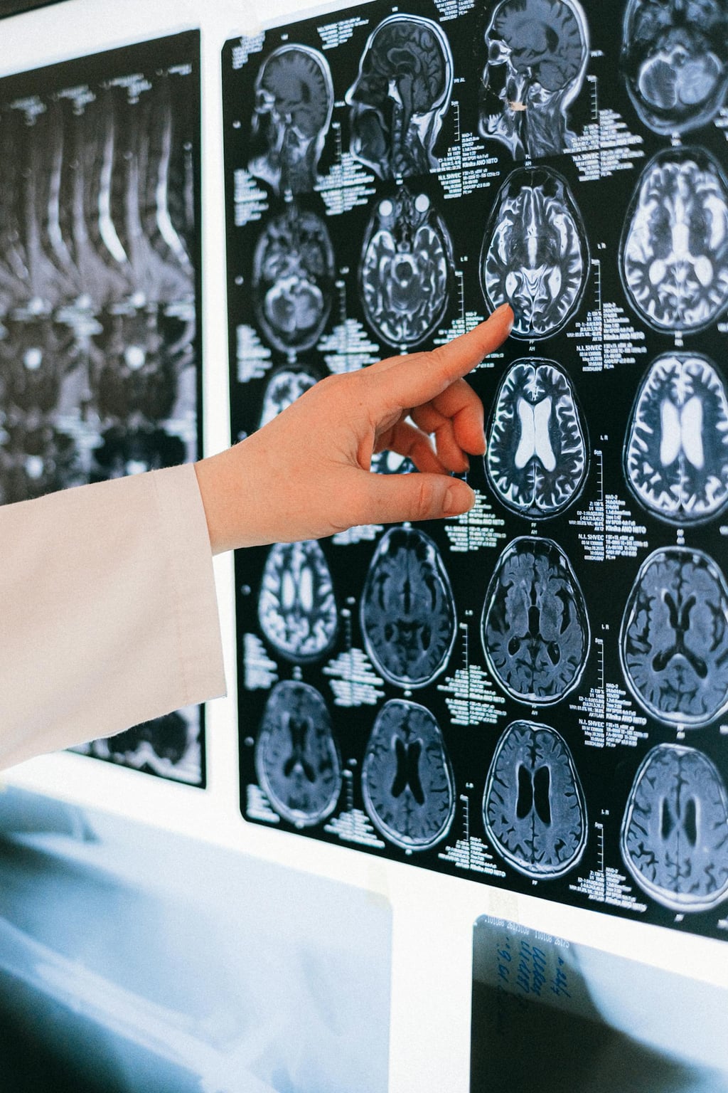 Neurologie — Clinique Médicale Spécialisée Cocody Abidjan